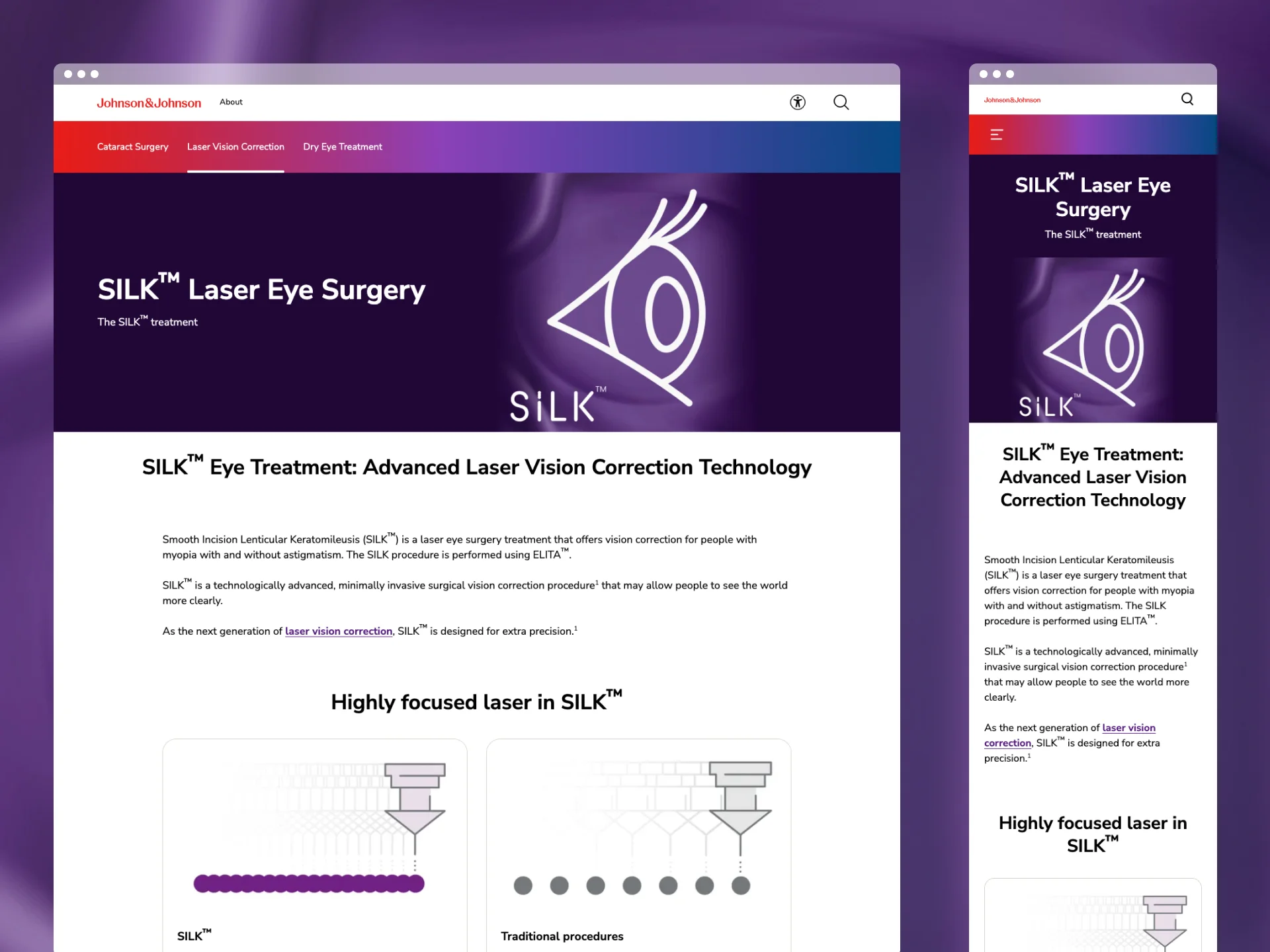 SILK laser eye surgery page shown on desktop and mobile.